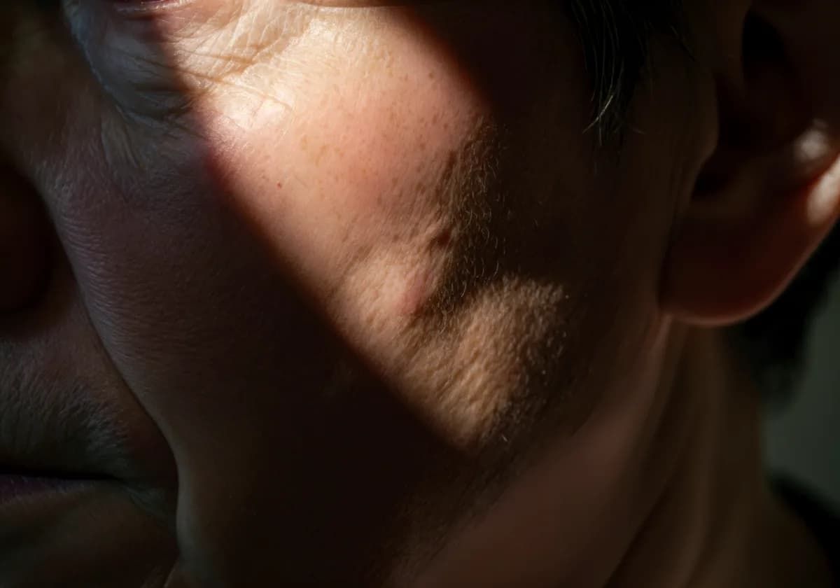 Masterclass Botulinum für erfahrene Ärzt:innen